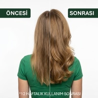 ASHLEY JOY ASHLEY JOY Ashley Joy Şampuan Hacim Veren 400 ml 1 of 7