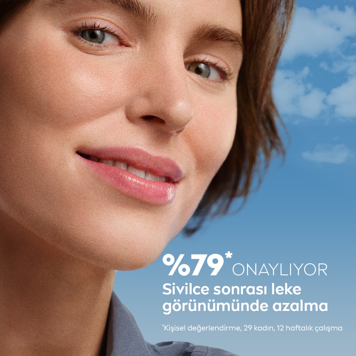  NIVEA VISAGE NIVEA VISAGE Nivea Luminous630 Sivilce Lekesi Karşıtı Serum 30 ml Salisilik ve Hyaluronik Asit  1 of 6 