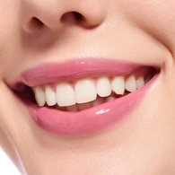  ESSENCE ESSENCE Essence Extreme Shine Volume Dudak Parlatıcısı 21  1 of 15 