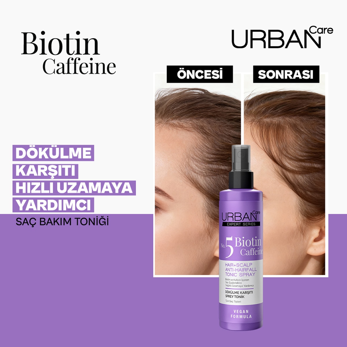  URBAN CARE URBAN CARE Urban Care Expert Saç Toniği Biotin&Caffeine 200 ml  1 of 10 