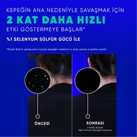 HEAD&SHOULDERS HEAD&SHOULDERS Head&Shoulders Şampuan Clinical Itch Relief 400 ml 1 of 6