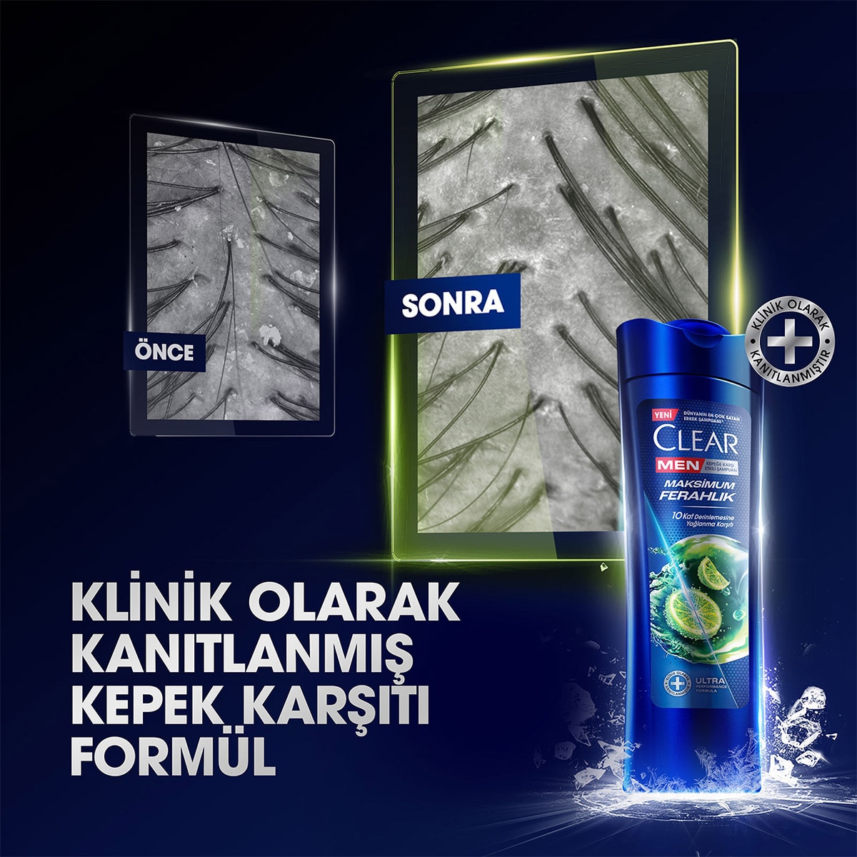 CLEAR CLEAR Clear Men Kepeğe Karşı Etkili Şampuan Maksimum Ferahlık 350 ml 1 of 11