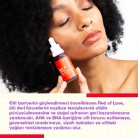 She Vec Red Of Love Leke ve Akne Karşıtı Serum 30 ml
