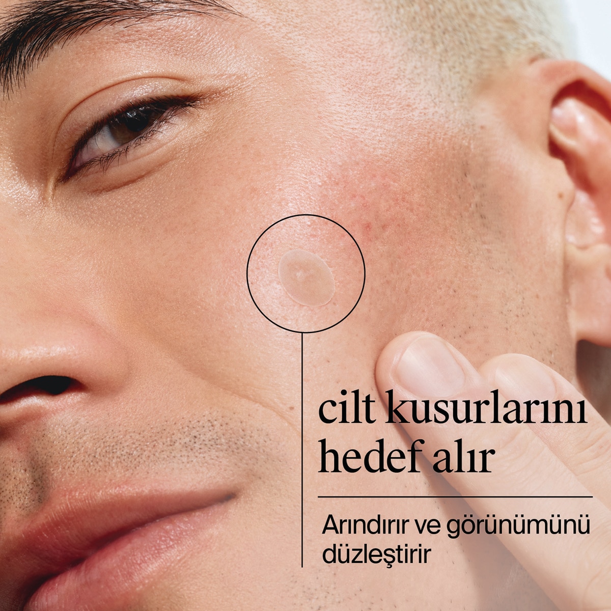 NEUTROGENA NEUTROGENA Neutrogena Ultra Thin Blemish Patch Sivilce Bandı 24’lü  1 of 6 