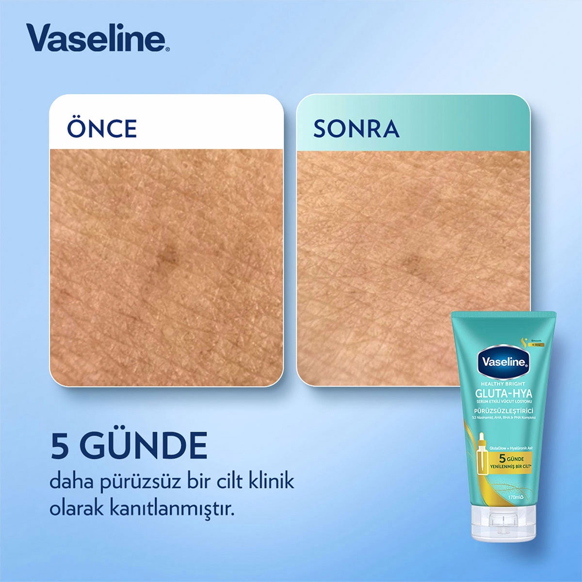  VASELINE VASELINE Vaseline Gluta-Hya Serum Etkili Vücut Losyonu Pürüzsüzleştirici 170 ml  1 of 7 