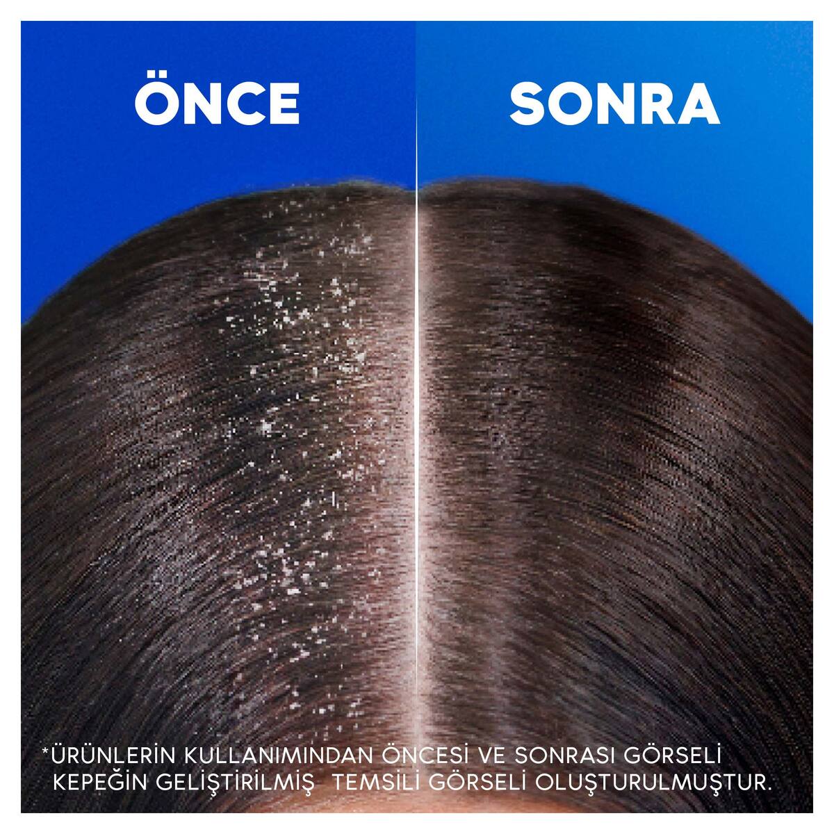  HEAD&SHOULDERS HEAD&SHOULDERS Head&Shoulders Klasik Bakım 2'si 1 Arada Kepeğe Karşı Etkili Şampuan 250 ml  1 of 6 