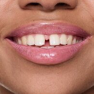 ESSENCE ESSENCE Essence Milky Glazed Glossy Lip Balm 02 1 of 11