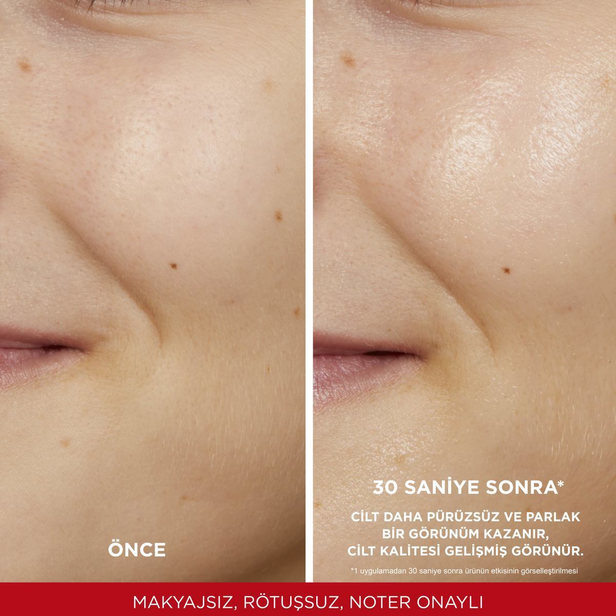LOREAL PARIS LOREAL PARIS L'Oreal Paris Revitalift %5 Saf Glikolik Asit Peeling Etkili Tonik 1 of 5
