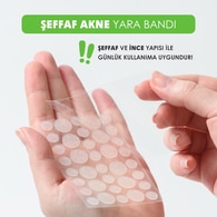 Mia Klinika Akne Bandı