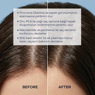 HC CARE HC CARE HC Care Şampuan Dandruff Control 300 ml 1 of 5