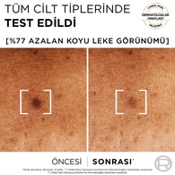 L'Oreal Paris Bright Reveal Koyu Leke Karşıtı Serum 10%Niasinamid 30 ml Sivilce, Güneş, Yaşlanma Lekelerinde Etkili