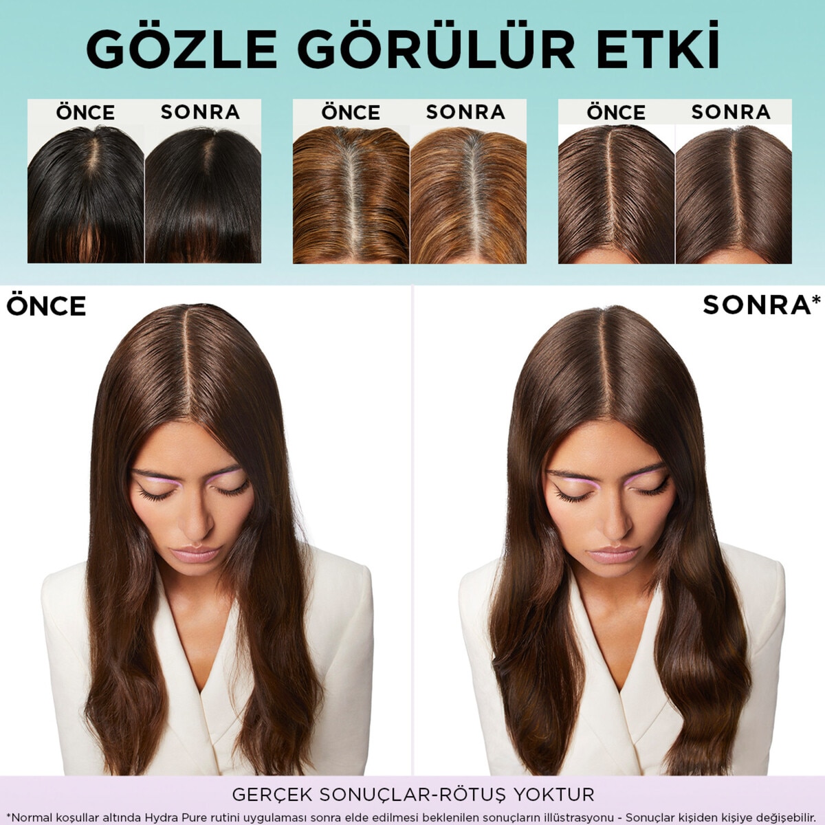 ELSEVE ELSEVE L'Oreal Paris Elseve Hydra Hyaluronic Pure Salisilik Asit İçeren Yağlanma Karşıtı Arındırıcı Şampuan 300 ml 1 of 8