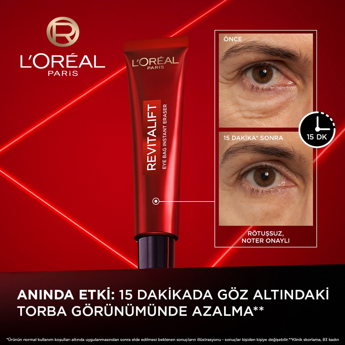  LOREAL PARIS LOREAL PARIS L'Oreal Paris Revitalift Lazer Eyebag Instant Eraser Göz Altı Torba Görünümüne Karşı Etkili Göz Kremi 15 ml  1 of 9 
