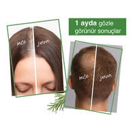 Yoon Dökülme Karşıtı Saç Suyu 200 ml