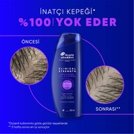 HEAD&SHOULDERS HEAD&SHOULDERS Head&Shoulders Şampuan Clinical Oil Control 400 ml 1 of 6