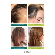PH LAB PH LAB Ph Lab Scalp Shot PDRN 15 ml 1 of 8