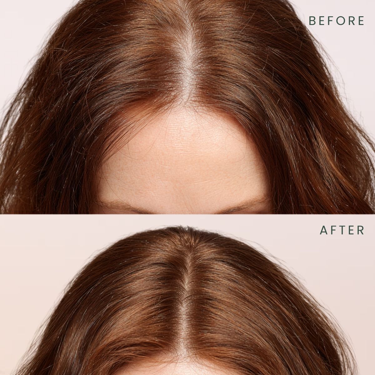  MATSU PROFESSIONAL MATSU PROFESSIONAL Matsu Saç Serumu Rosemary Scalpify 50 ml  1 of 6 