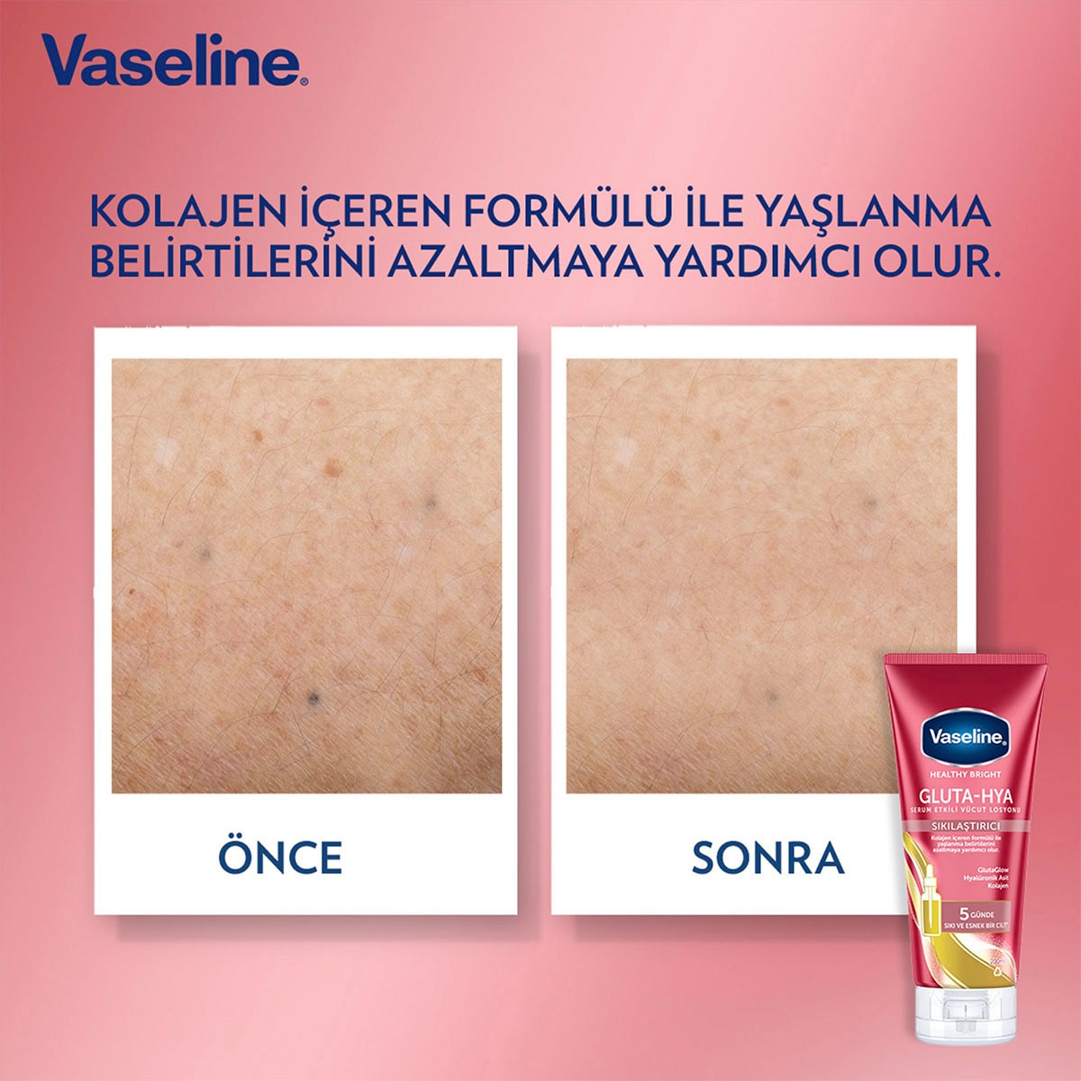  VASELINE VASELINE Vaseline Gluta-Hya Serum Etkili Vücut Losyonu Sıkılaştırıcı 200 ml  1 of 7 