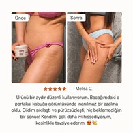 EPIFY EPIFY Epify Anti Selülit Jel Krem 150 ml 1 of 5