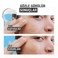 Neutrogena Hydro Boost Niasinamid Serum 30 ml