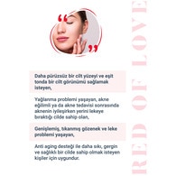 She Vec Red Of Love Leke ve Akne Karşıtı Serum 30 ml