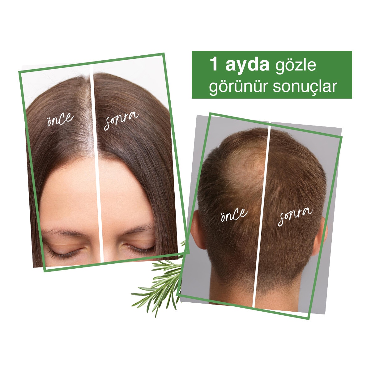  YOON YOON Yoon Scalp Serum 50 ml  1 of 6 