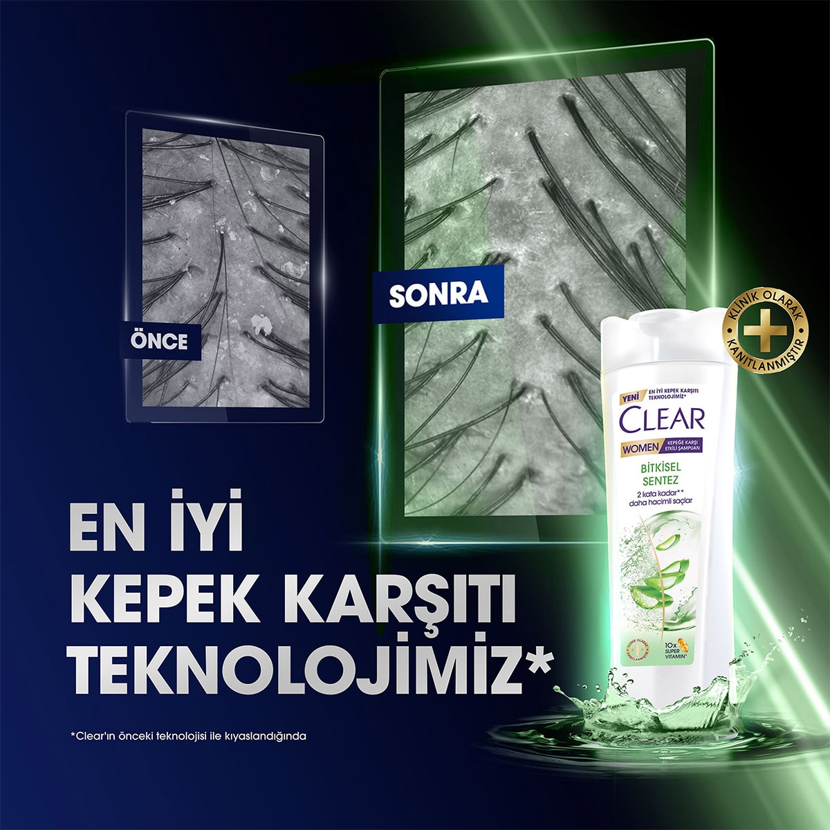  CLEAR CLEAR Clear Women Kepeğe Karşı Etkili Şampuan Bitkisel Sentez 350 ml  1 of 11 