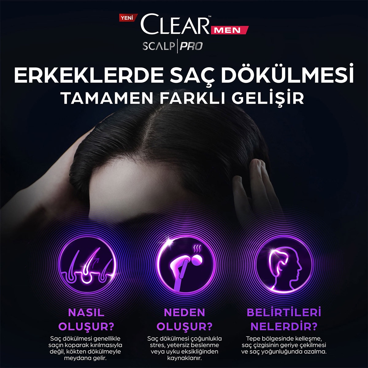  CLEAR CLEAR Clear Men Scalp Pro Saç Dökülmesine Karşı Güçlendirici Şampuan 300 ml  1 of 9 