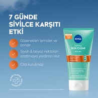 Nivea Derma Skin Clear Sivilce Karşıtı Peeling 150 ml