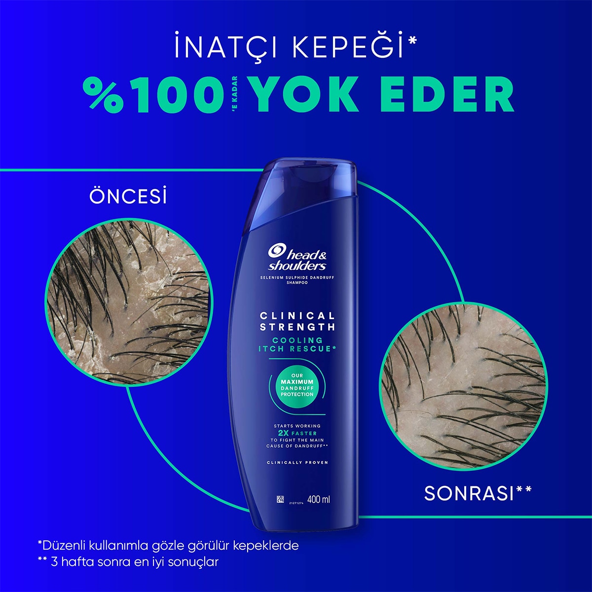  HEAD&SHOULDERS HEAD&SHOULDERS Head&Shoulders Şampuan Clinical Itch Relief 400 ml  1 of 6 