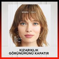 L'Oreal Paris Skin Ink Gün Boyu Kapatıcı Fondöten Nötr Alt Ton 15