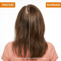 ASHLEY JOY ASHLEY JOY Ashley Joy Dökülme Karşıtı Tonik Saç Spreyi 150 ml 1 of 8