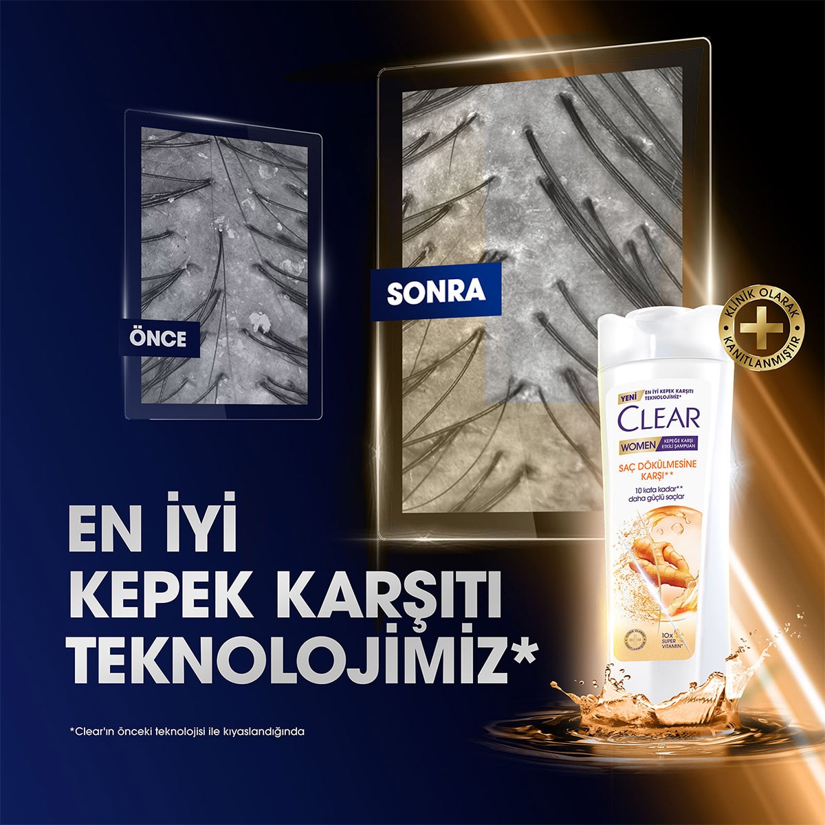  CLEAR CLEAR Clear Women Kepeğe Karşı Etkili Şampuan Saç Dökülmesine Karşı 350 ml  1 of 10 