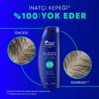 HEAD&SHOULDERS HEAD&SHOULDERS Head&Shoulders Şampuan Clinical Itch Relief 400 ml 1 of 6