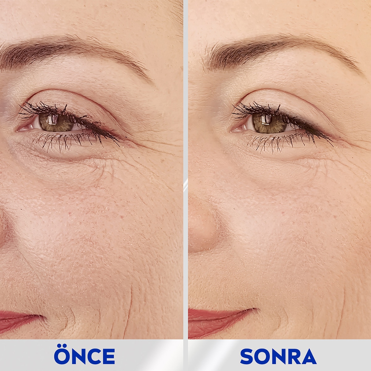  NIVEA VISAGE NIVEA VISAGE Nivea Q10 Anında Etkili Kırışıklık Karşıtı Serum 15 ml  1 of 10 