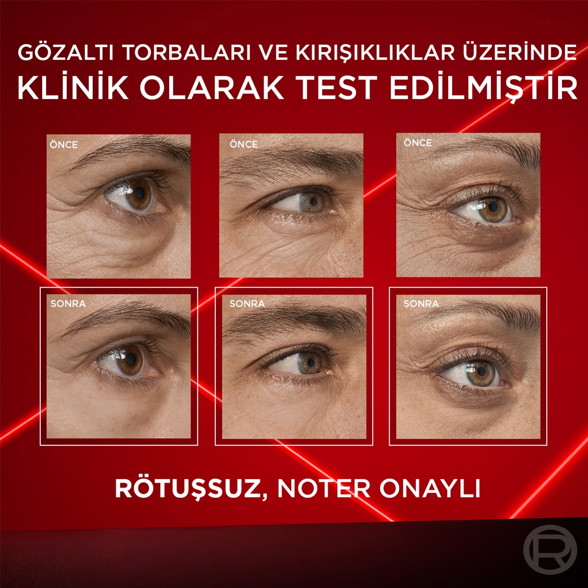  LOREAL PARIS LOREAL PARIS L'Oreal Paris Revitalift Lazer Eyebag Instant Eraser Göz Altı Torba Görünümüne Karşı Etkili Göz Kremi 15 ml  1 of 9 