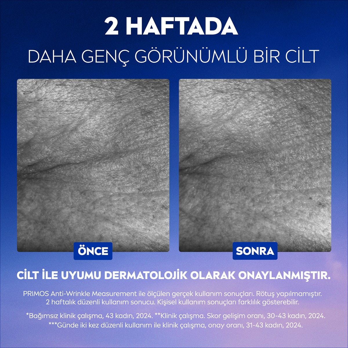  NIVEA VISAGE NIVEA VISAGE Nivea Cellular Epigenetics Rejuvenating Yaşlanma Karşıtı Cilt Serumu 30 ml  1 of 8 