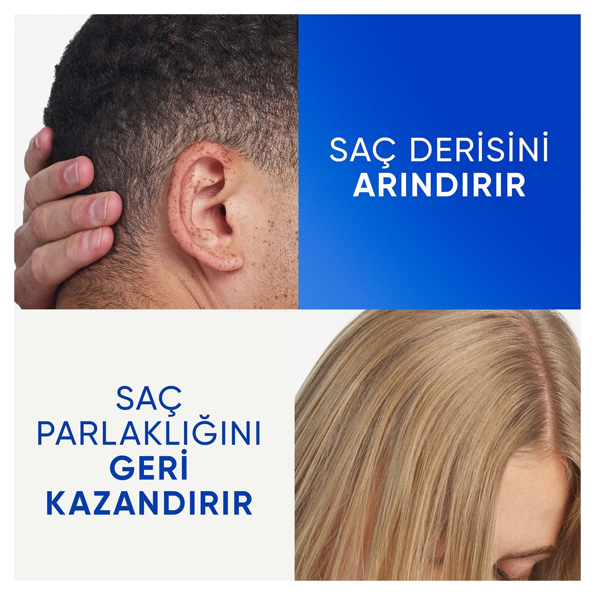 HEAD&SHOULDERS HEAD&SHOULDERS Head&Shoulders Arındırma ve Parlaklık Kepek Karşıtı Şampuan Elma Sirkesi 800 ml 1 of 5