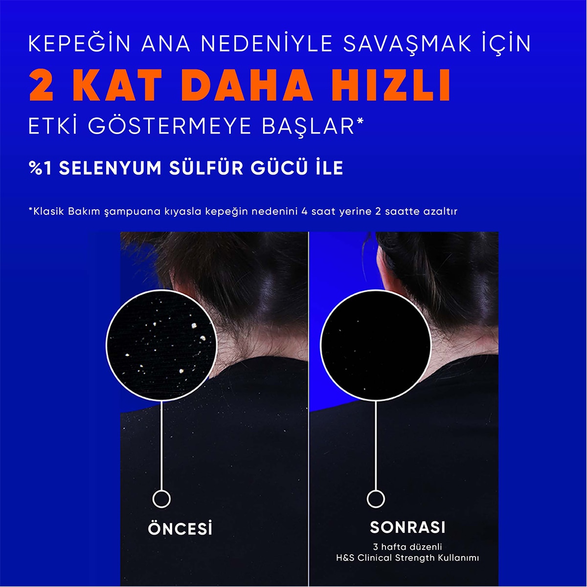 HEAD&SHOULDERS HEAD&SHOULDERS Head&Shoulders Şampuan Clinical Dry Scalp 400 ml 1 of 6