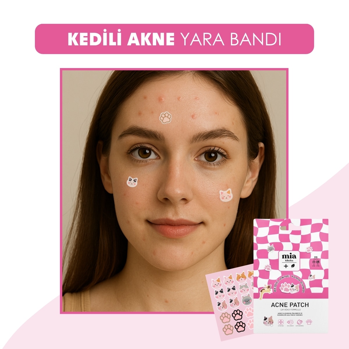  MIA KLINIKA MIA KLINIKA Mia Klinika Kedili Akne Bandı 1 Adet  1 of 5 