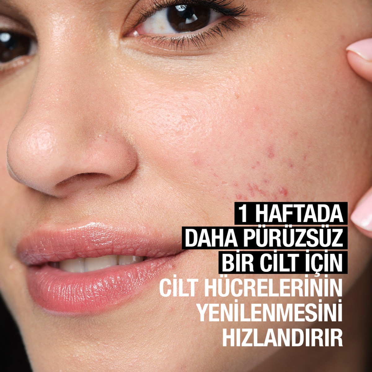  NEUTROGENA NEUTROGENA Neutrogena Sivilce Karşıtı Peeling Etkili Tonik 155 g  1 of 7 