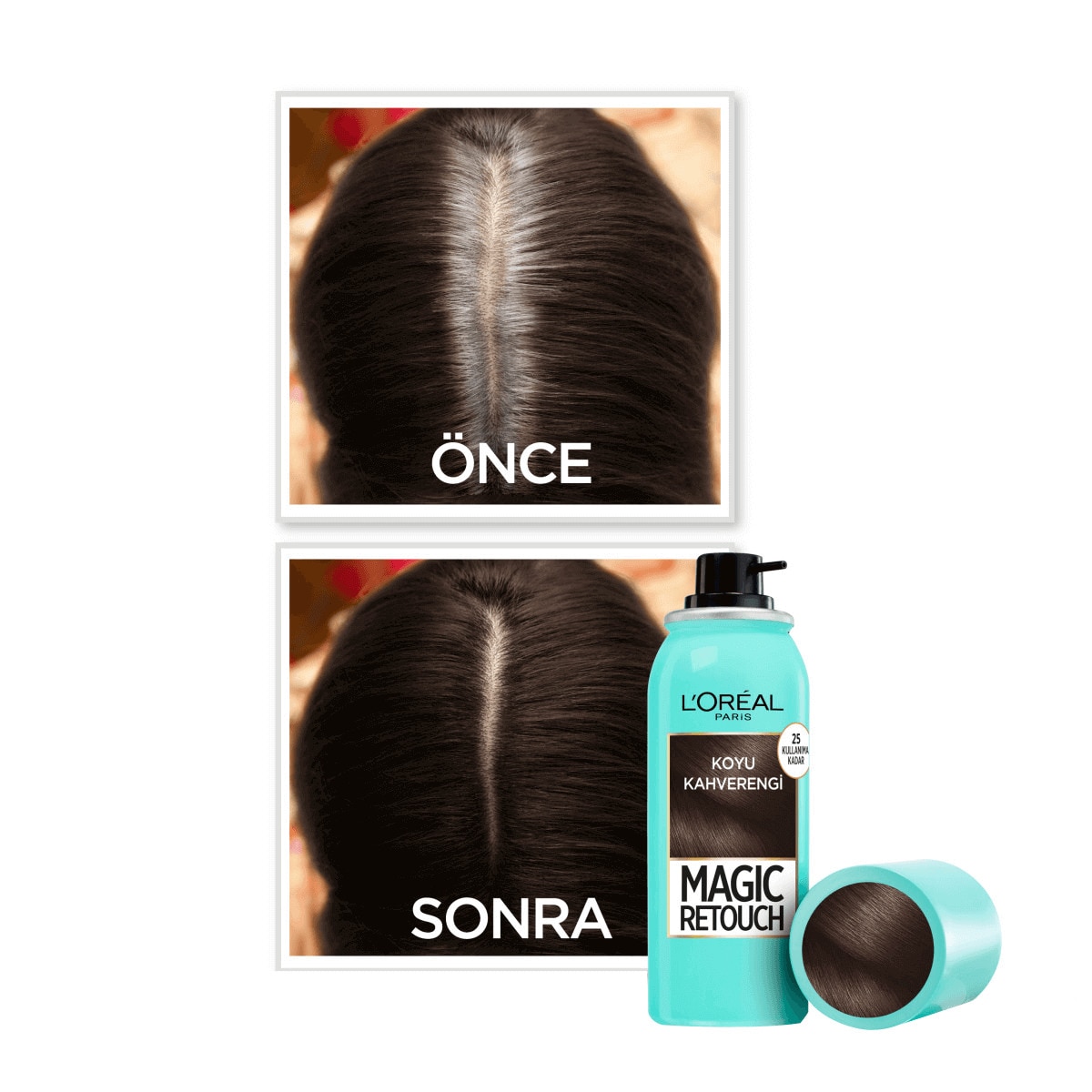 LOREAL MAGIC RETOUCH LOREAL MAGIC RETOUCH Magic Retouch Beyaz Saçlar İçin Kapatıcı Koyu Kahverengi Saç Spreyi 75 ml 1 of 4