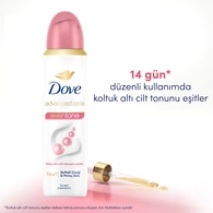 DOVE DOVE Dove Kadın Sprey Deodorant Eventone Kalendula Özü 150 ml 1 of 11