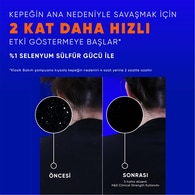 HEAD&SHOULDERS HEAD&SHOULDERS Head&Shoulders Şampuan Clinical Dry Scalp 400 ml 1 of 6