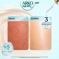  ARKO ARKO Arko Nem Extra Serum Yatıştırıcı Losyon 200 ml  1 of 6 