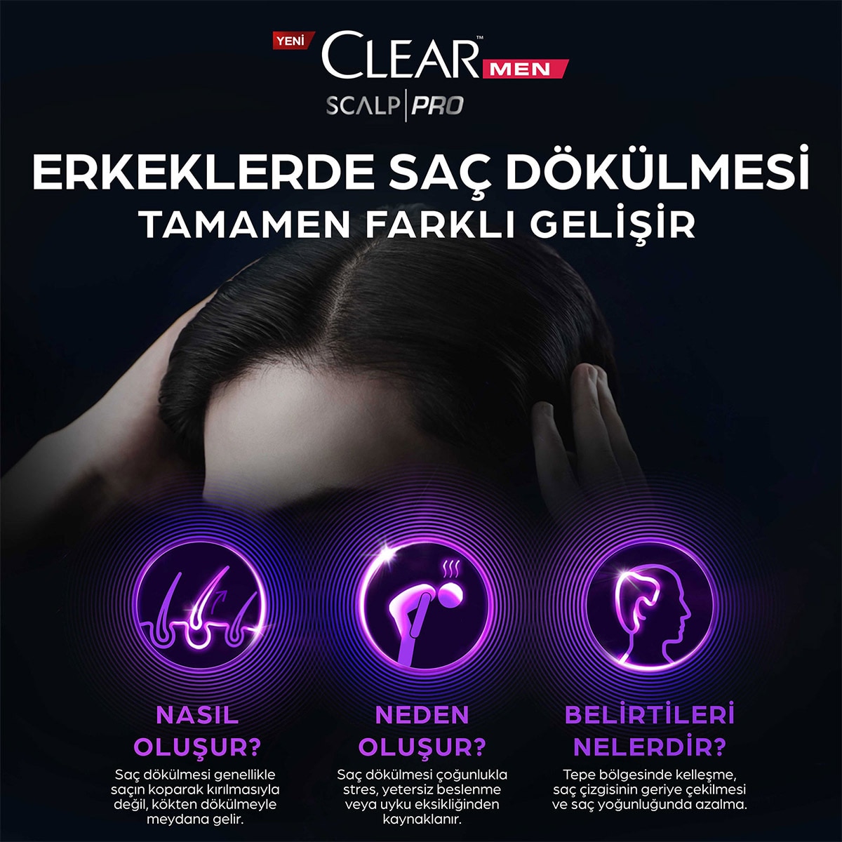  CLEAR CLEAR Clear Men Scalp Pro Saç Dökülmesine Karşı Güçlendirici Serum 70 ml  1 of 7 
