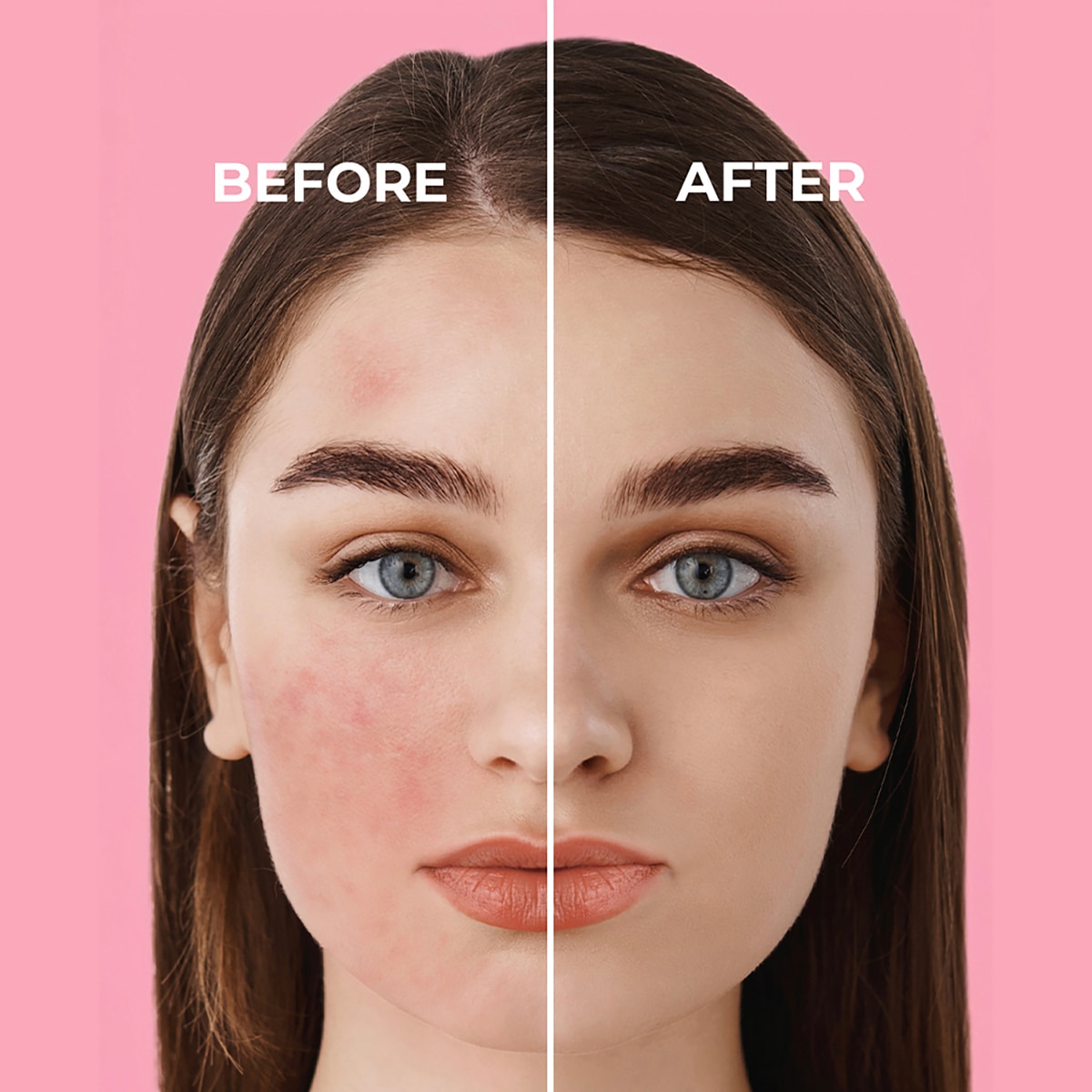  SİNOZ SINOZ Sinoz Pink Touch Ton Eşitleyici Güneş Kremi Spf50+  1 of 10 