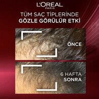 Elseve Komple Direnç Dökülme Karşıtı Saç Bakım Kremi 250 ml