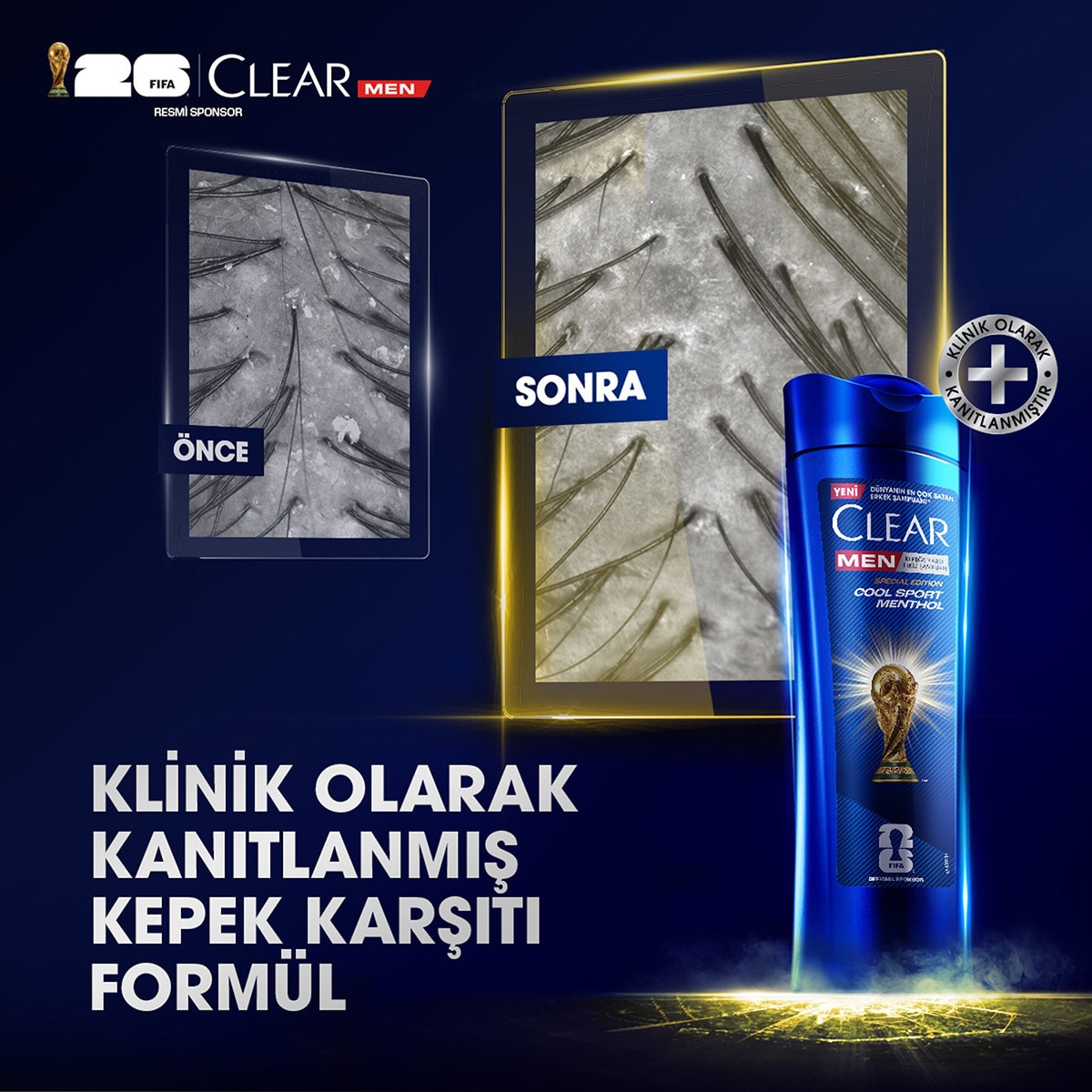 CLEAR CLEAR Clear Men Kepeğe Karşı Etkili Şampuan Cool Sport Menthol 350 ml 1 of 13