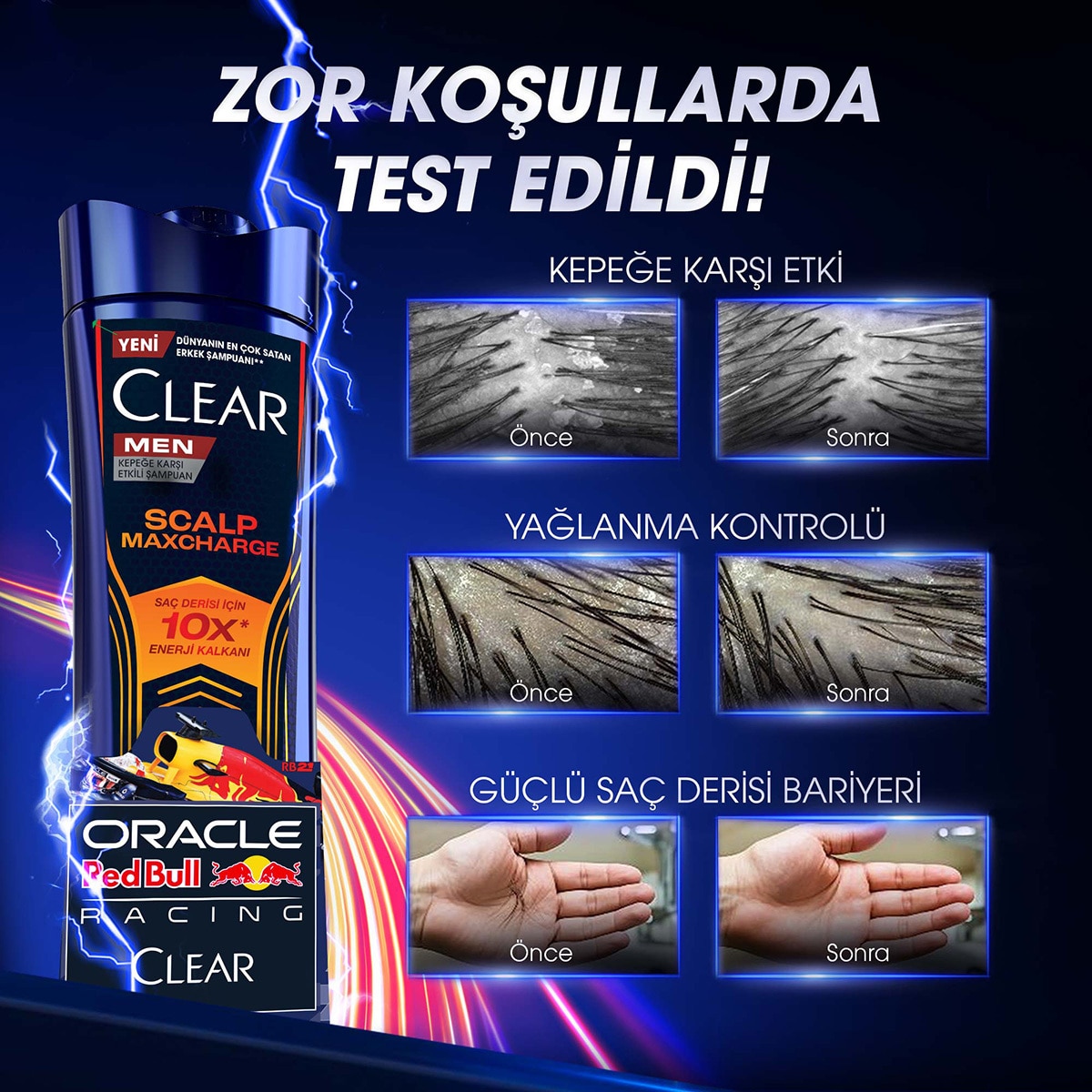  CLEAR CLEAR Clear Men Şampuan Redbull Kepeğe Karşı 330 ml  1 of 11 